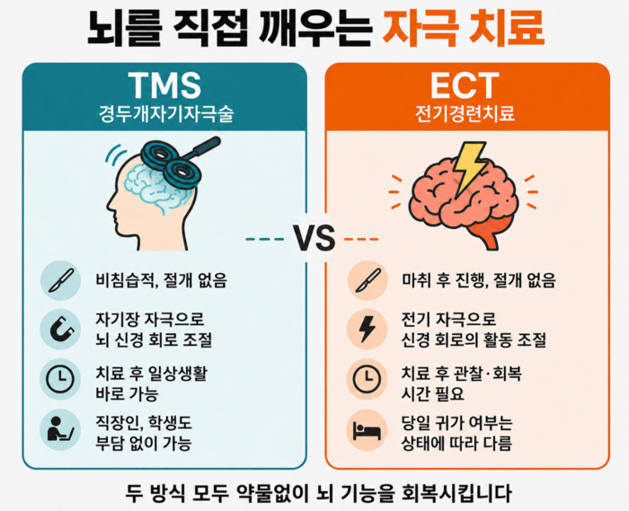 TMS와 ECT 뇌 자극 치료 비교 인포그래픽