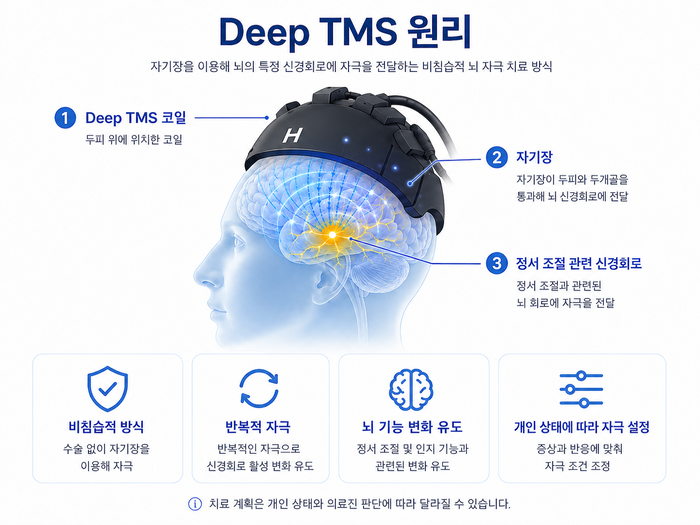 Deep TMS 장비와 뇌 자극 원리를 보여주는 도식 이미지