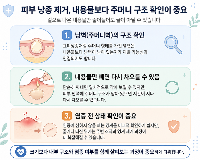피지낭종 재발 원인과 내부 구조를 보여주는 이미지