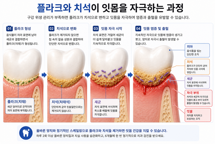 잇몸치료가 늦어졌을 때 생길 수 있는 잇몸 변화 이미지
