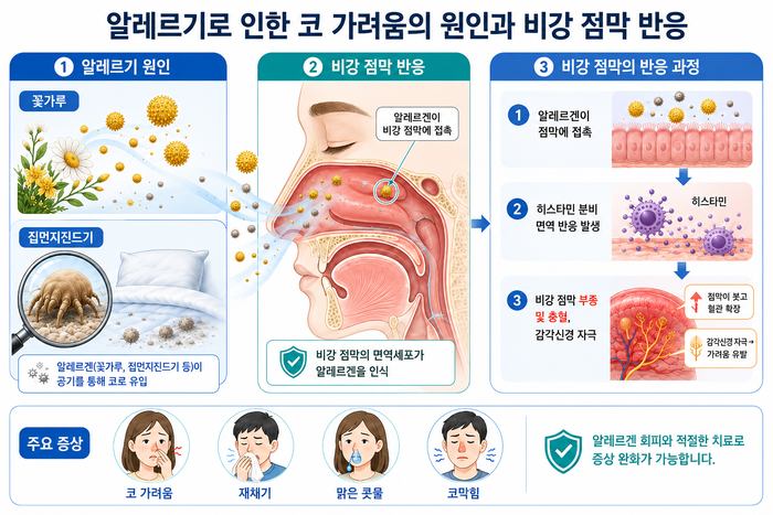 알레르기성 비염으로 인한 코 가려움 설명 이미지