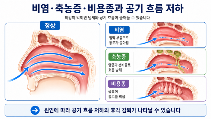 비염과 부비동염이 후각 저하에 미치는 영향을 보여주는 그림