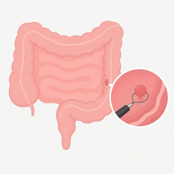 대장 용종절제술로 알아보는 용종의 종류와 사후 관리