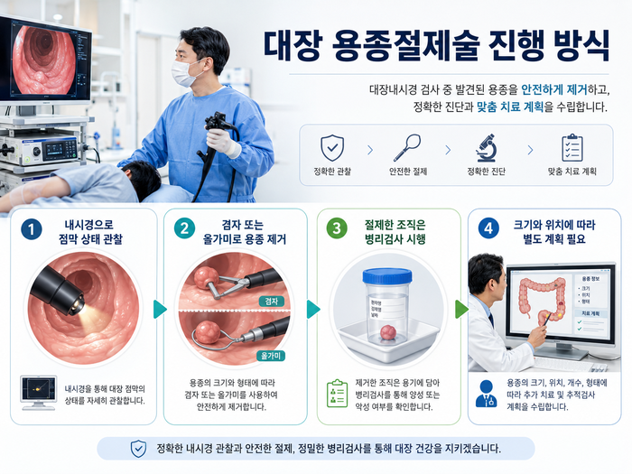 내시경을 이용한 대장 용종절제술 절차 이미지