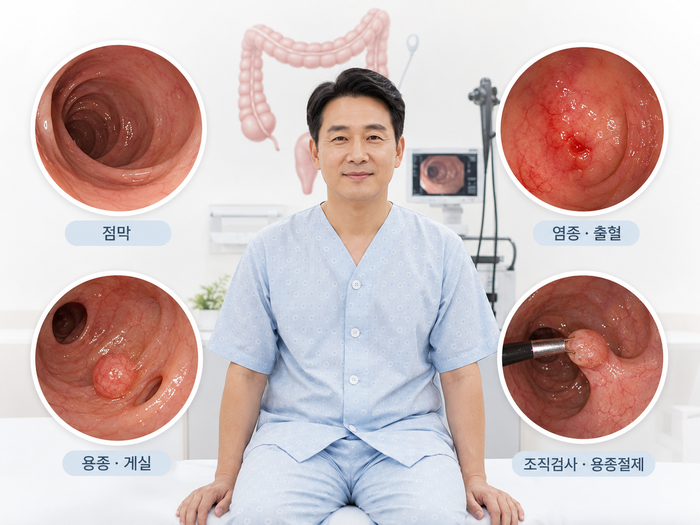 대장내시경 검사 과정 설명 이미지