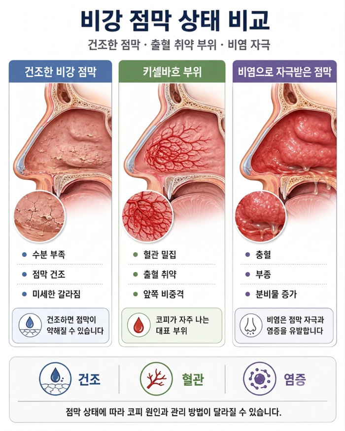 건조한 코 점막과 코피 발생 부위 설명 이미지