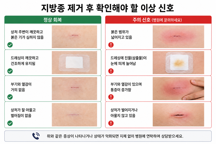 지방종제거 후 주의해야 할 경고 신호와 감염 징후 안내 이미지