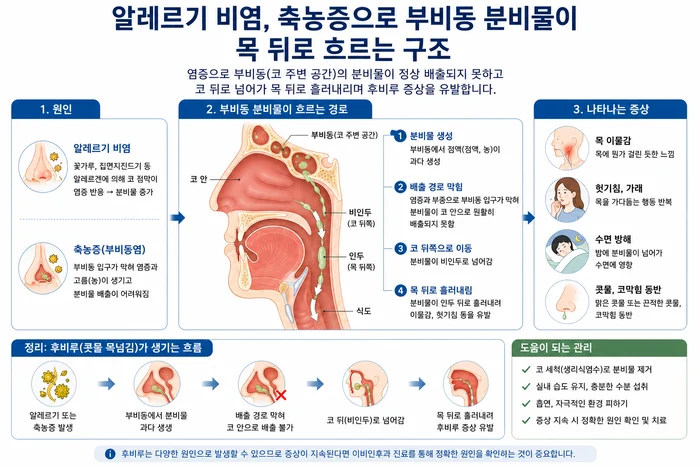 알레르기 비염과 부비동염이 후비루에 미치는 영향 설명 이미지