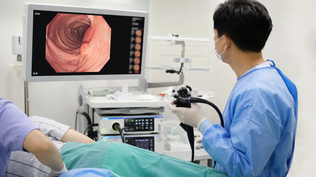 Colonoscopy-showing-small-colon-polyp-on-endoscopy-monitor