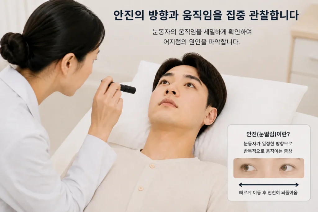 이석증 검사 중 안진의 방향과 형태를 관찰하는 과정을 설명하는 그림