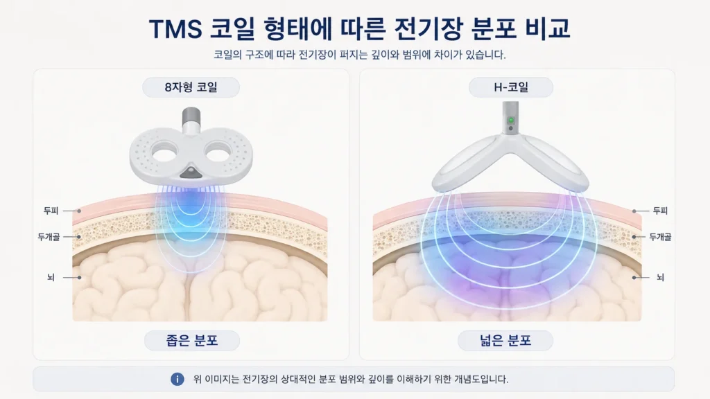 deep-tms-h-coil-electric-field