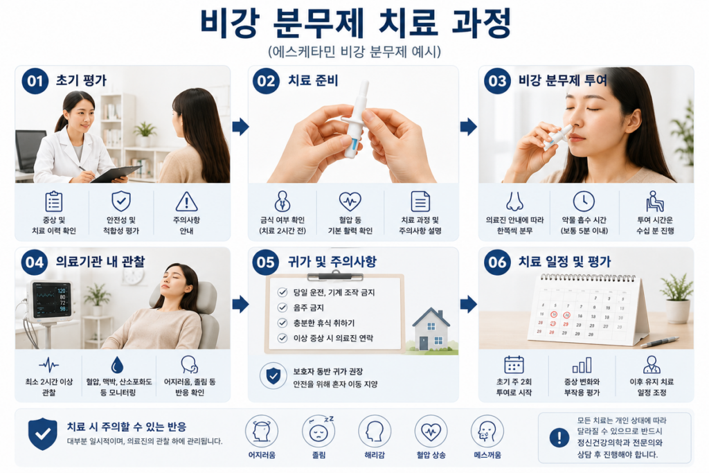 에스케타민 비강 분무제 치료 과정을 묘사한 이미지