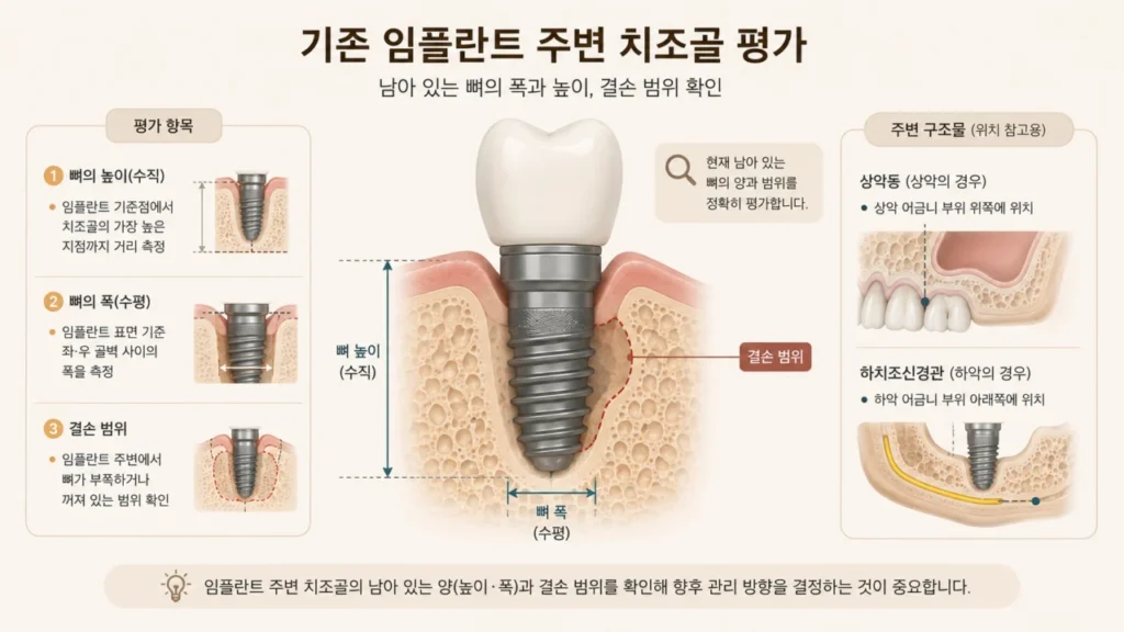 implant-bone-defect-assessment