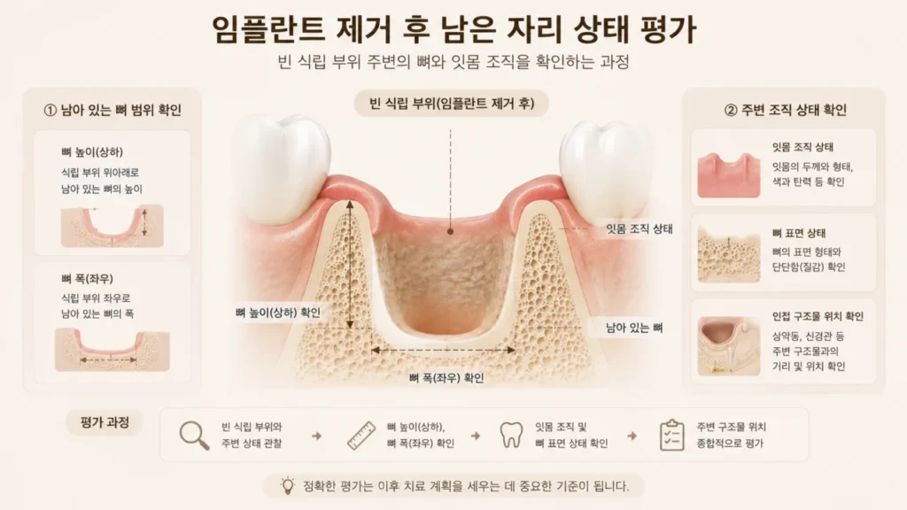 implant-removal-site-bone-check