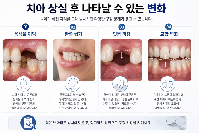 치아 상실 후 생활 체크리스트 안내 그림