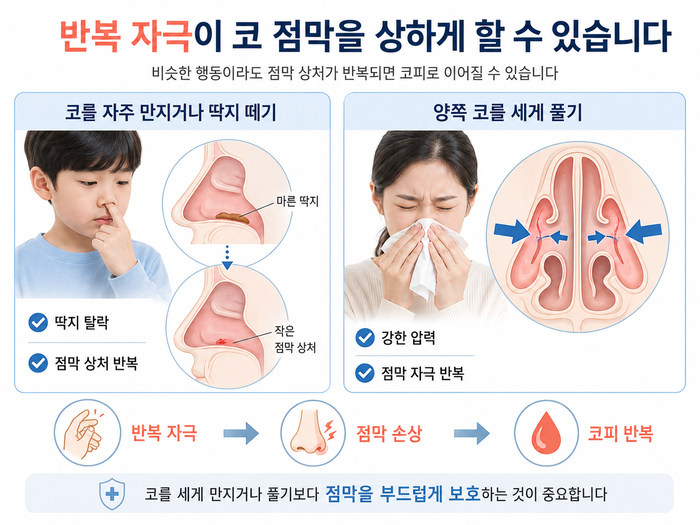 코를 후비거나 세게 푸는 습관이 점막에 자극을 주는 모습을 설명하는 그림