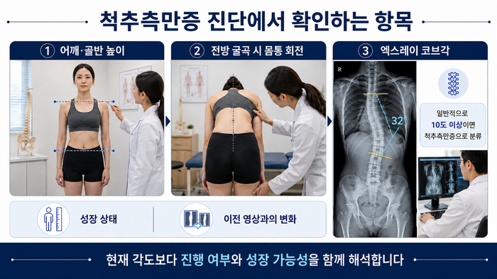 코브각 측정으로 척추측만증을 진단하는 방법을 설명하는 그림