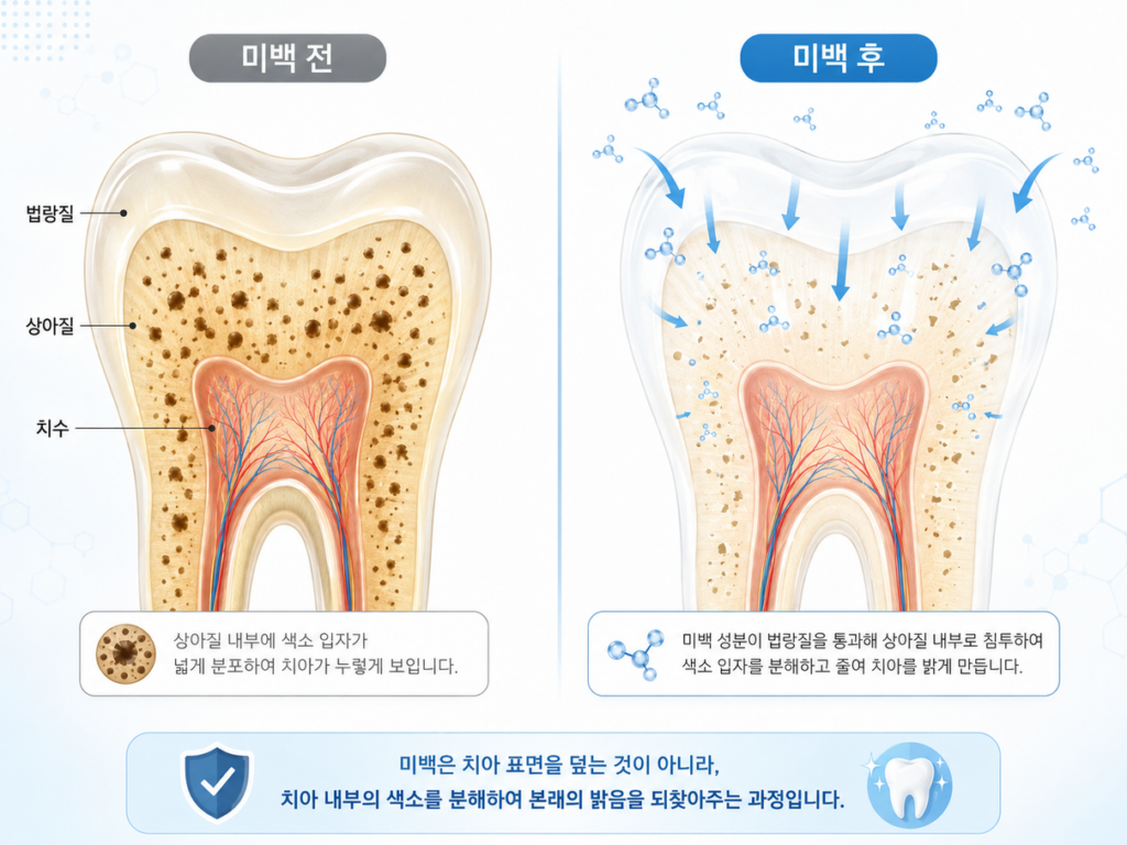 치아미백의 원리를 설명하는 그림