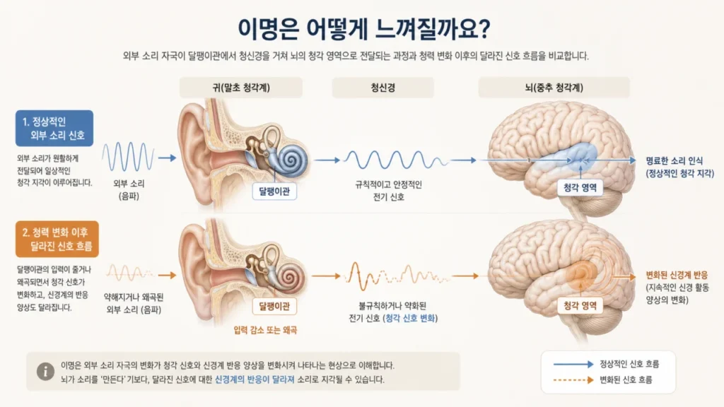 tinnitus-auditory-signal-brain-processing