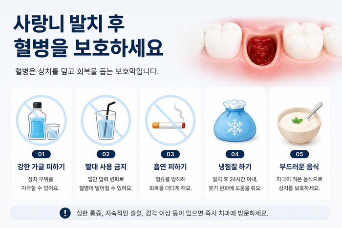 사랑니 발치 후 혈병 보호와 회복 수칙을 설명하는 그림