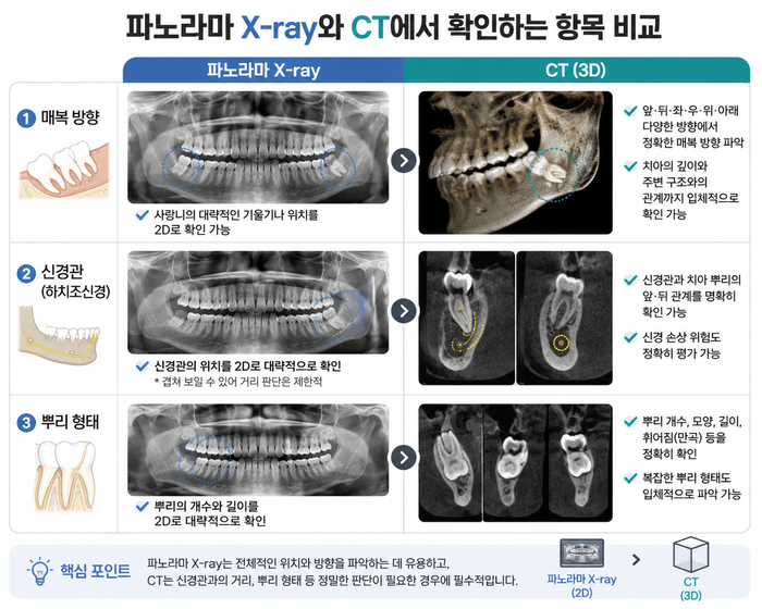파노라마와 CT 영상으로 사랑니 위치와 신경관, 뿌리 형태를 비교하는 그림