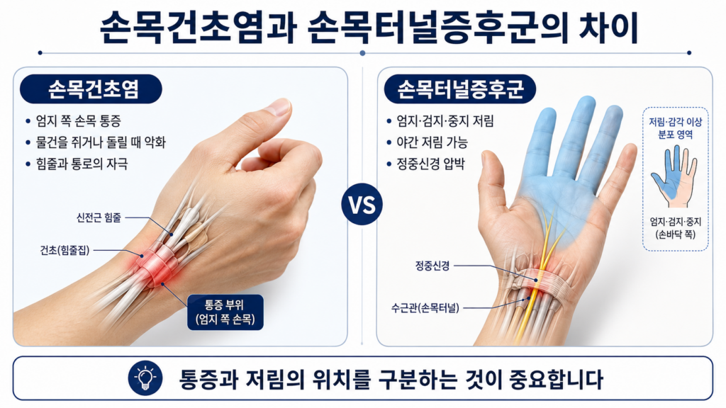 wrist-tenosynovitis-vs-carpal-tunnel-korean-1
