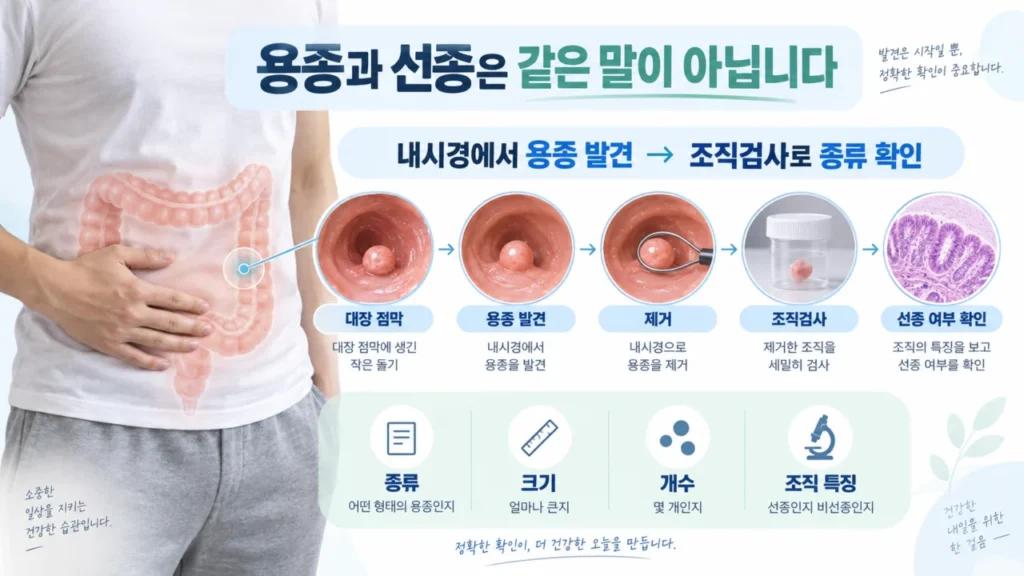 대장용종과 선종의 조직검사 결과 차이를 설명하는 그림