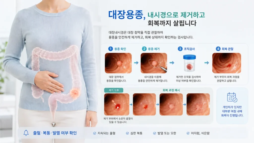 대장용종 제거 부위의 회복 과정과 출혈, 복통, 발열 확인을 설명하는 그림