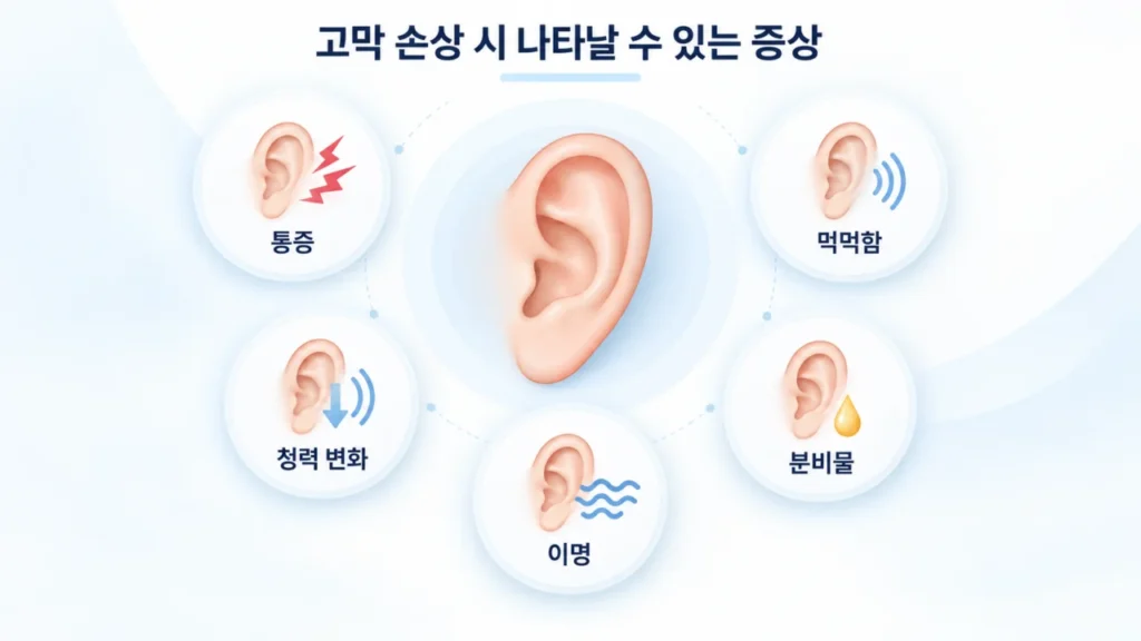 고막천공의 주요 증상인 통증, 먹먹함, 청력 변화, 이명, 분비물을 설명하는 이미지