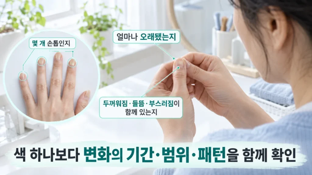 손톱 변색의 지속 기간과 범위를 확인하는 인포그래픽