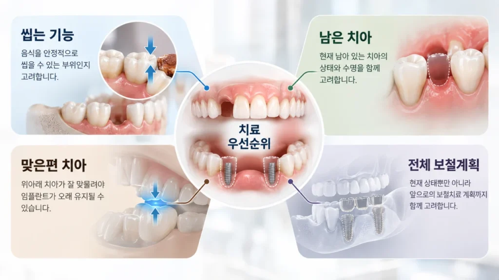 보험 임플란트 2개 적용 위치를 계획하는 치과 치료 모식도