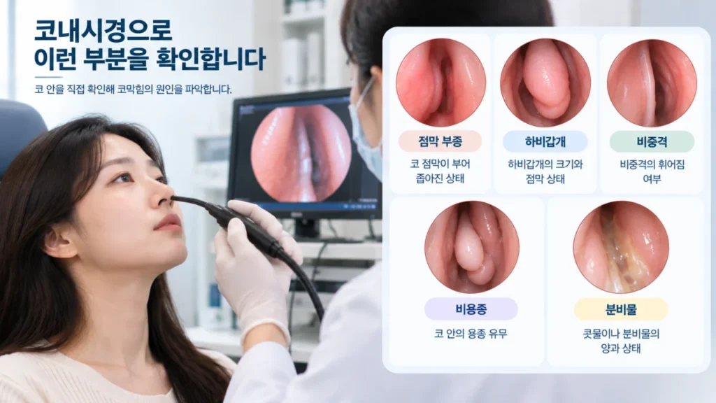 코내시경으로 코 점막과 하비갑개, 비중격 상태를 확인하는 모습
