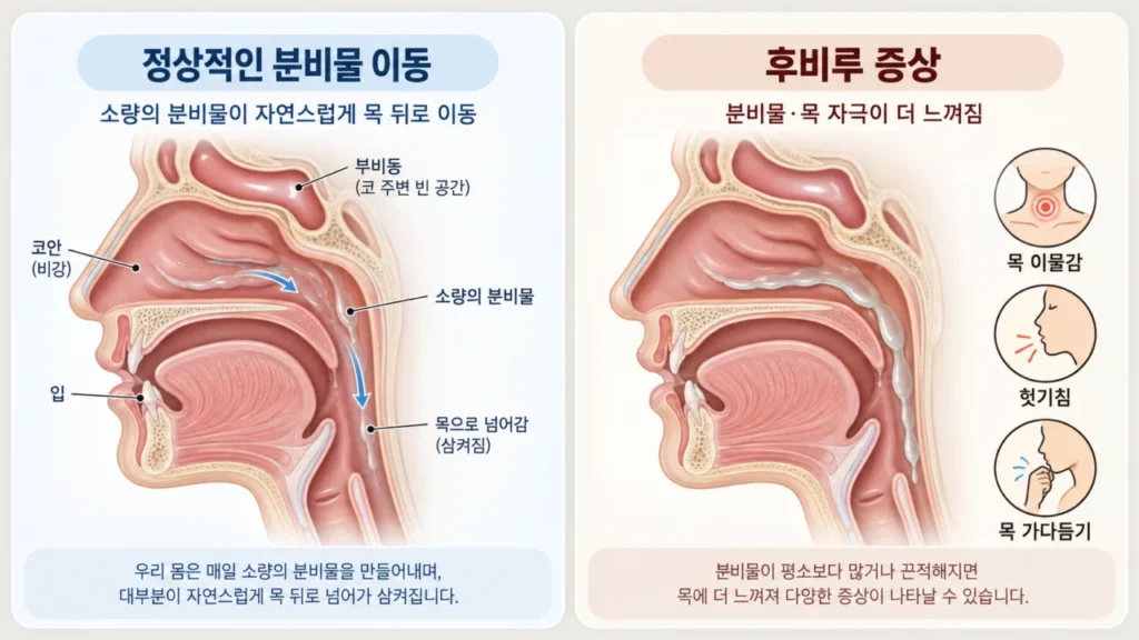 콧물이 목으로 넘어가는 느낌은 왜 생길까? 후비루 원인과 확인 방법