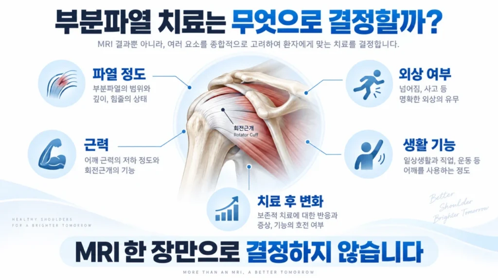 회전근개 부분파열 치료 결정에 영향을 주는 다양한 요소를 나타낸 그림