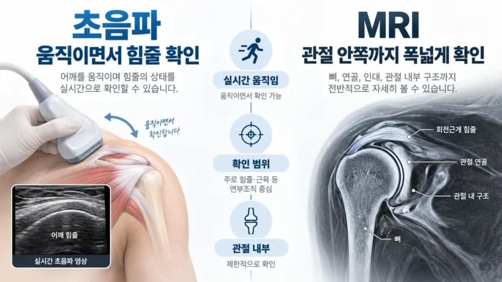 초음파와 MRI가 각각 어떤 구조를 확인하는지 비교한 이미지