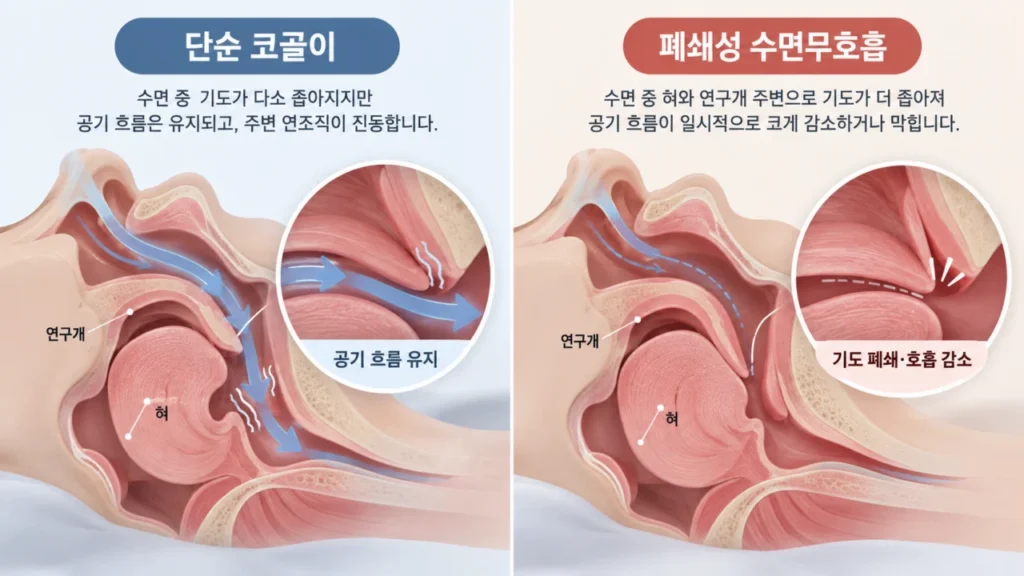 snoring-vs-obstructive-sleep-apnea-airway