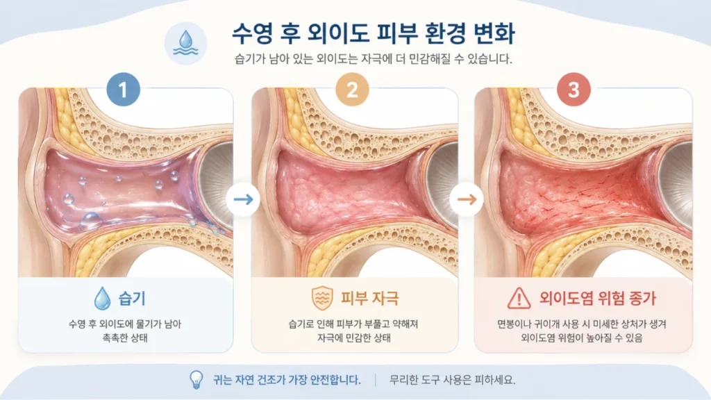 [귀에 염증이 생겼어요 3편] 수영 후 귀가 아프고 가려운 이유는? 외이도염 증상과 관리 방법