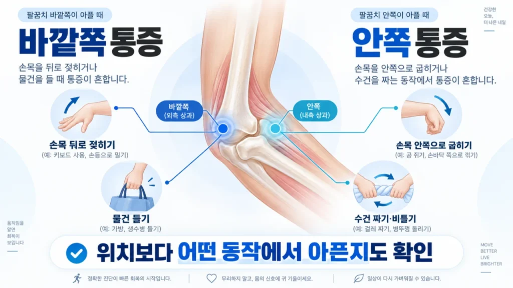 테니스엘보와 골프엘보에서 손목 동작별 통증 부위를 설명하는 그림