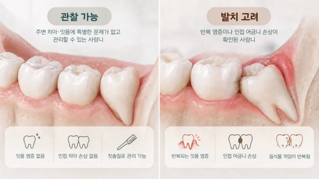 wisdom-tooth-observe-vs-extract-summary