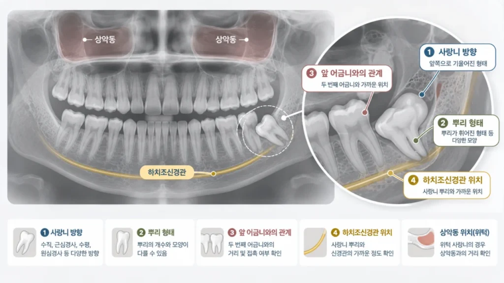 wisdom-tooth-panoramic-check-points