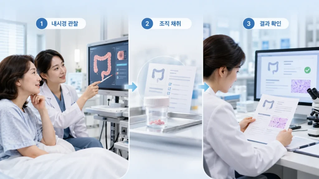 대장내시경과 조직검사 과정을 도식화한 그래픽