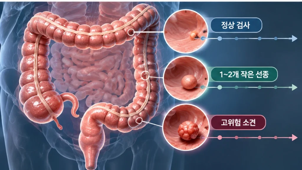 대장내시경 재검사 시기와 용종 특성의 관계를 보여주는 이미지