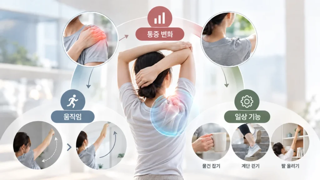 프롤로주사 후 통증과 기능 변화를 함께 확인하는 과정을 나타내는 그림