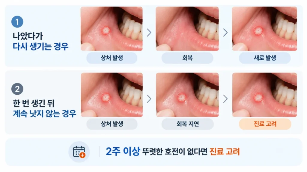 구내염의 회복 경과와 반복 발생을 시간 흐름으로 보여주는 그림